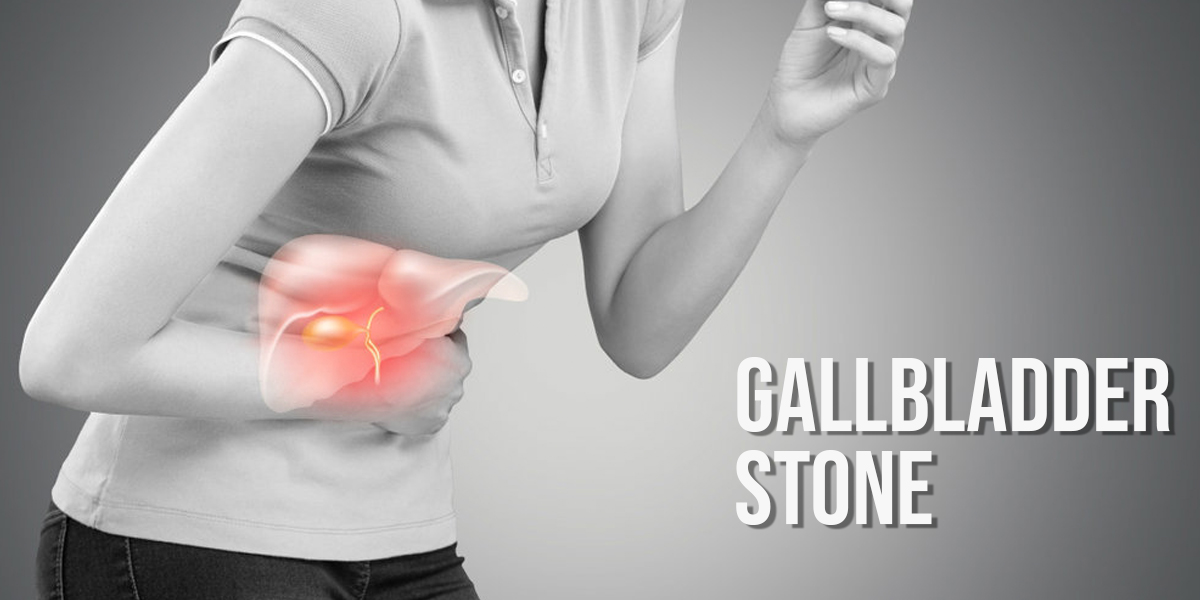 Gallbladder stones: Symptoms, Causes, Treatment, Surgery/ Operation Cost in Chandigarh