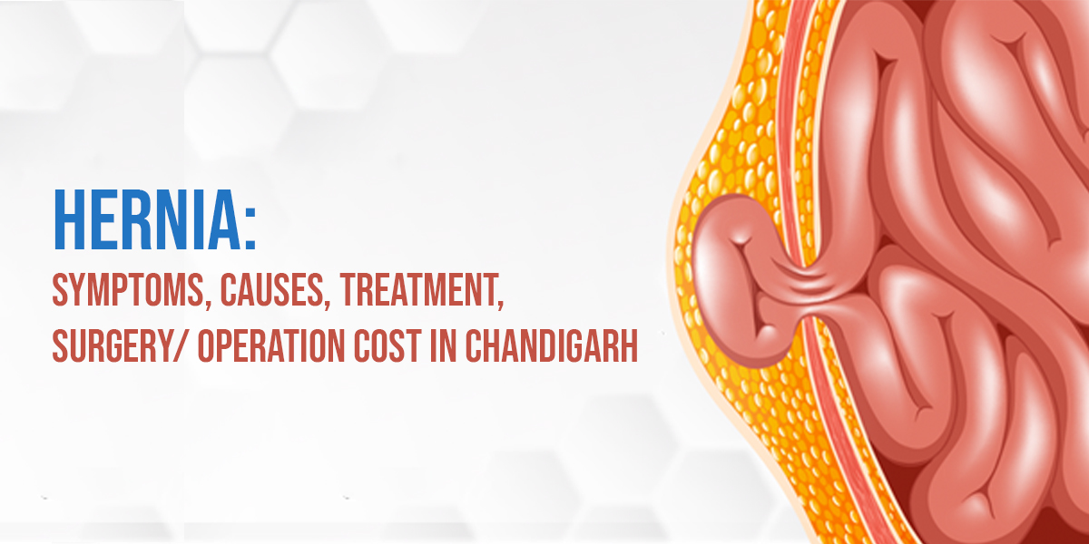 Hernia: Symptoms, Causes, Treatment, Surgery/ Operation Cost in Chandigarh