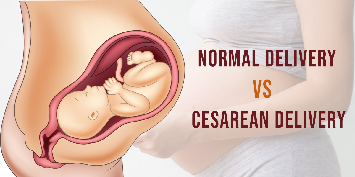 Cesarean Delivery vs Normal Delivery – Risks And Benefits – Healing Hospital Chandigarh