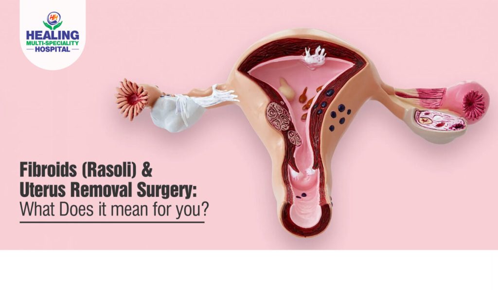 Fibroids Removal Surgery Healing Hostpital Chandigarh