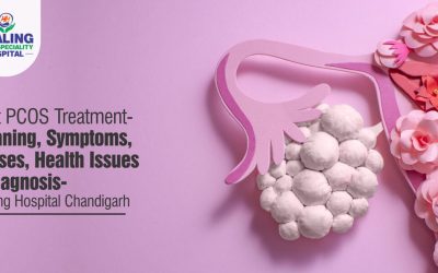 best pcos treatment in chandigarh