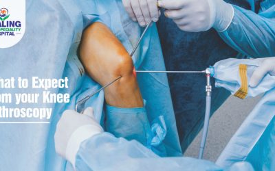 Knee arthroscopy