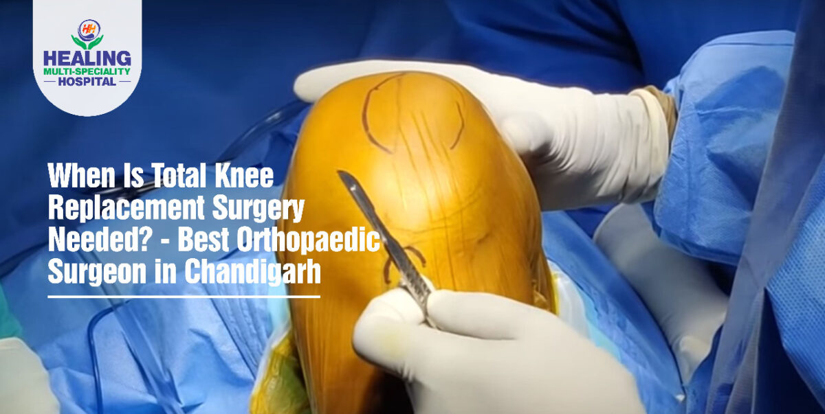 When Is Total Knee Replacement Surgery Needed? – Best Orthopaedic Surgeon in Chandigarh