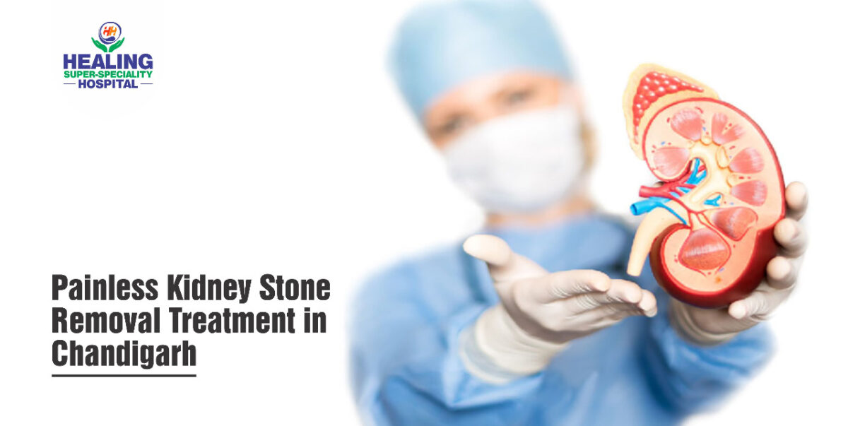 Painless Kidney Stone Removal Treatment in Chandigarh