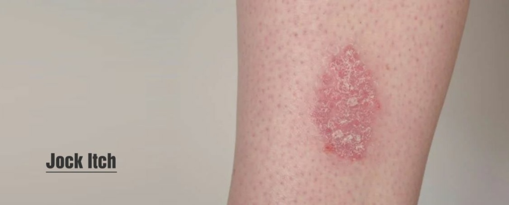 is itching a sign of healing or infection