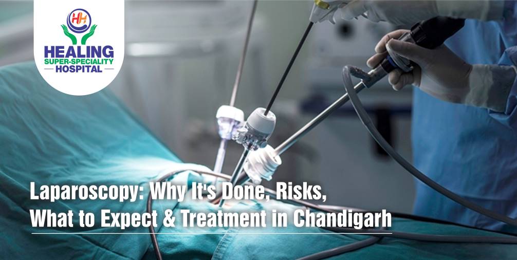 Laparoscopy: Why It’s Done, Risks, What to Expect & Treatment in Chandigarh