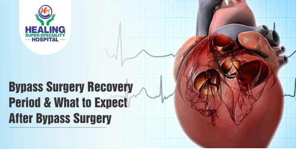 Bypass Surgery Recovery Period & What to Expect After Bypass Surgery