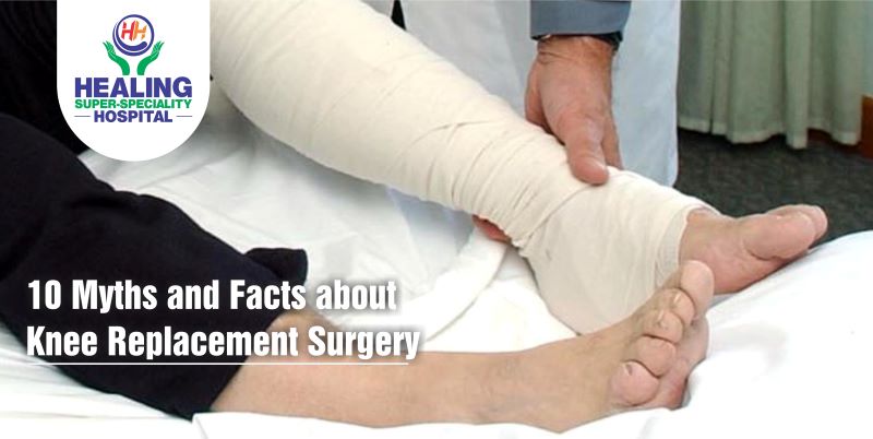 10 Myths and Facts about Knee Replacement Surgery