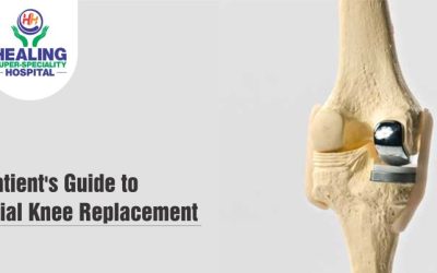 partial knee replacement in Chandigarh