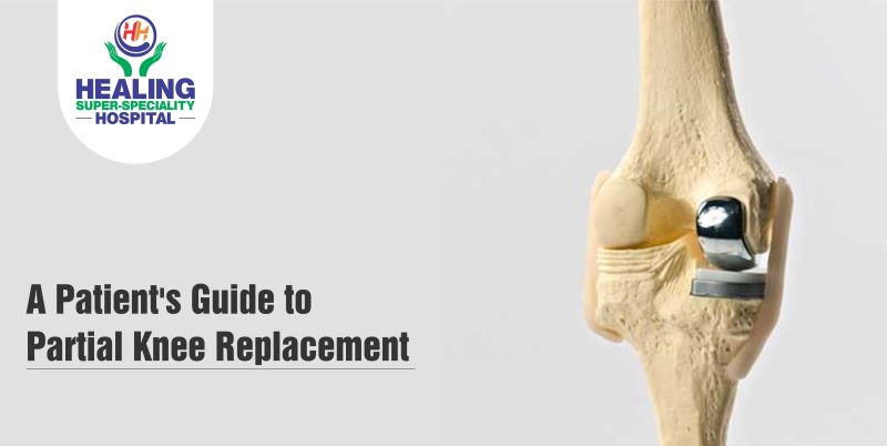 partial knee replacement in Chandigarh
