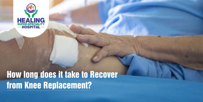How Long Does It Take To Recover From Knee Replacement?