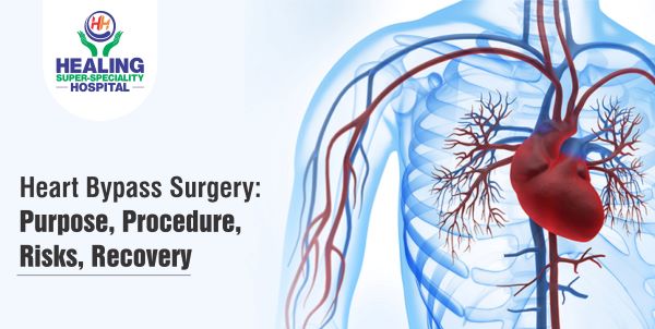 Heart Bypass Surgery: Purpose, Procedure, Risks, Recovery