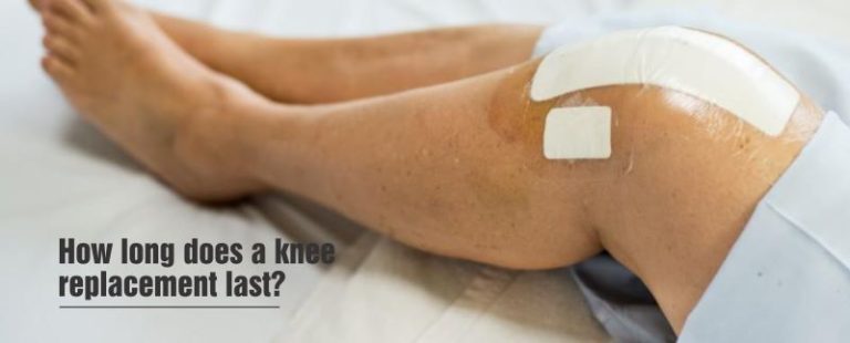 How Long Does It Take To Recover From Knee Replacement? - Healing Hospital
