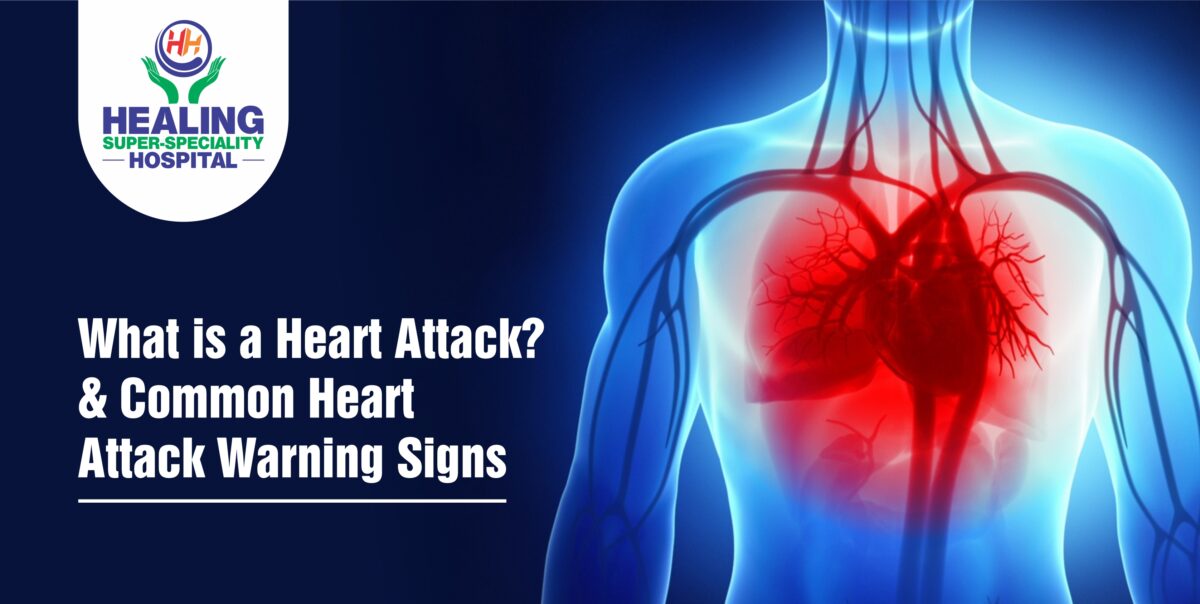 What is a Heart Attack? & Common Heart Attack Warning Signs