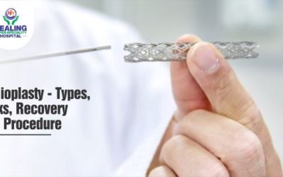 Best Hospital for Angioplasty in Chandigarh