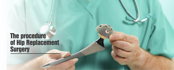 Hip Replacement Surgeon in Chandigarh