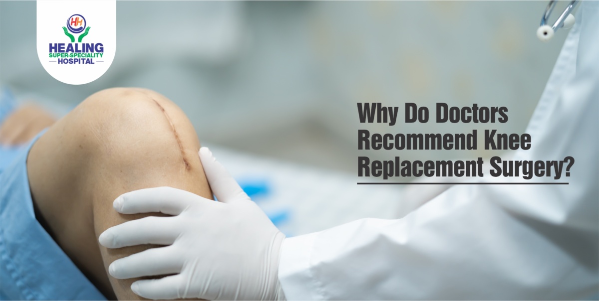 Why Do Doctors Recommend Knee Replacement Surgery?