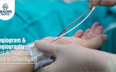 Angiography cost in Chandigarh
