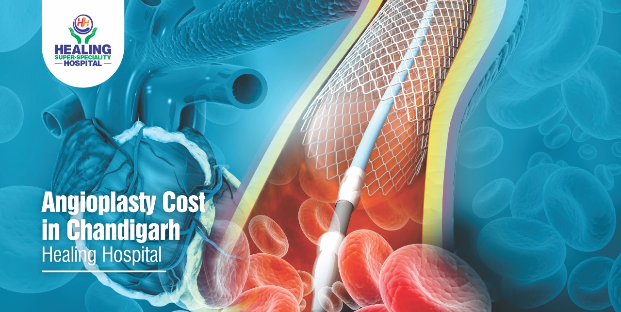 Angioplasty Cost in Healing hospital in Chandigarh