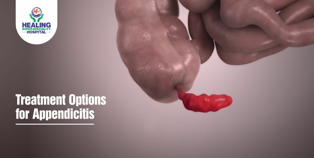 Appendicitis Treatment In Chandigarh,- Healing Hospital Chandigarh