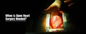 Open Heart Surgery and Bypass Surgery in Chandigarh - Healing Hospital in Chandigarh