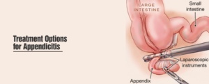 Treatment Options for Appendicitis in Chandigarh - Healing Hospital