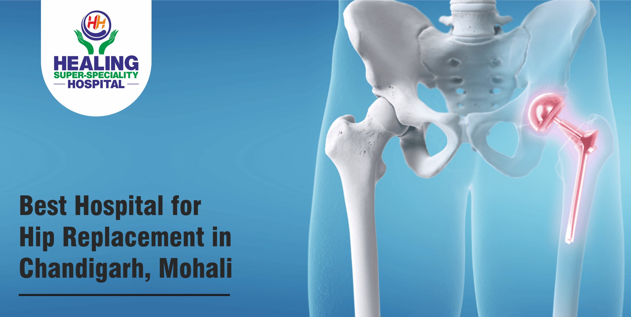Best Hospital for Hip Replacement in Chandigarh, Mohali