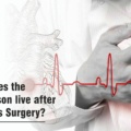 How Long Does The Average Person Live After Heart Bypass Surgery?
