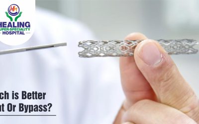 Healing Hospital Chandigarh Blog More stent or bypas