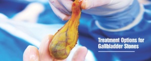 Healing Hospital Chandigarh Gallbladder stone Treatment in Chandigarh