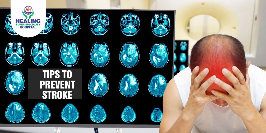 Tips To Prevent Stroke