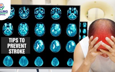 Tips To Prevent Stroke