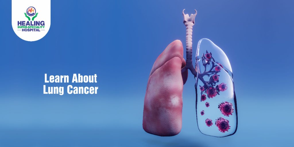 Lung Cancer Healing Hospital Chandigarh