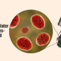 Know About Water Borne Diseases- Symptoms and Prevention