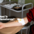 What Do You Need To Know About Chemotherapy?