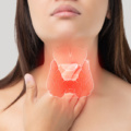 All you need to know about Thyroid Cancer