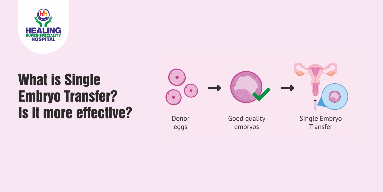 What is Single Embryo Transfer? Is it more effective? Healing Topic Image 1