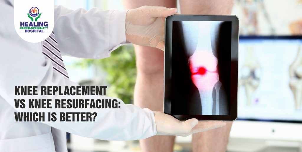 Total Knee Replacement in Chandigarh