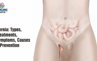 Hernia Treatment In Chandigarh