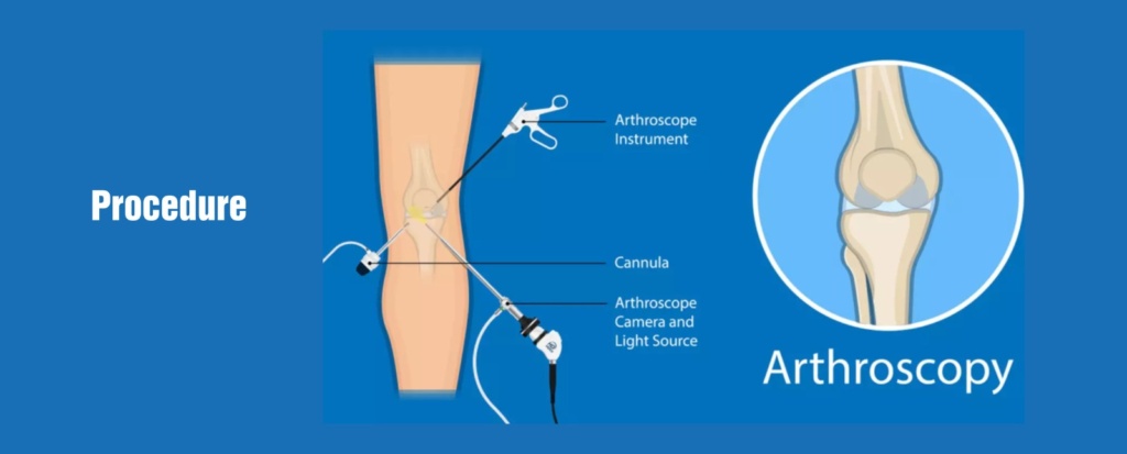 Best orthopedic doctor in Chandigarh 