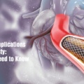 Risks and Complications of Angioplasty: What You Need to Know