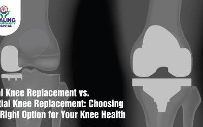 Total Knee Replacement in Chandigarh