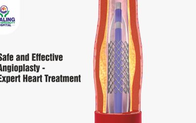 angioplasty specialist in Chandigarh