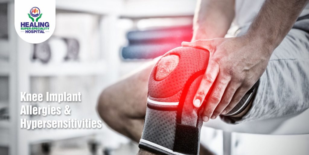 Best Knee Replacement Doctor in Chandigarh