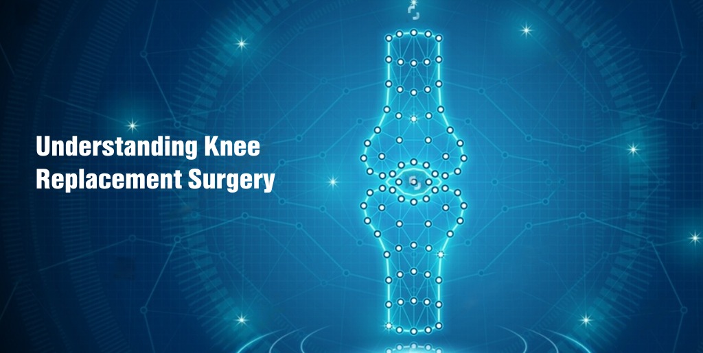 Knee replacement surgery in Delhi
