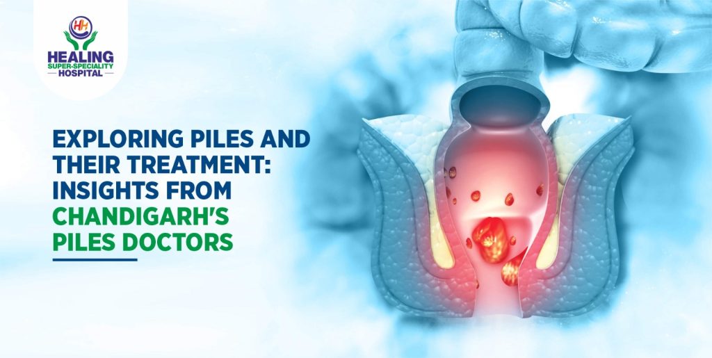 Piles doctor in Chandigarh