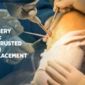 Knee Care Excellence: Navigating to the Best Knee Surgeon in Chandigarh