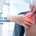 Affordable Joint Care: Unveiling FT 3D Knee Resurfacing Cost in India