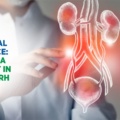 Urological Excellence: Choosing a Specialist in Chandigarh