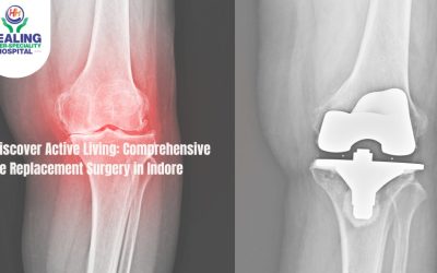 knee replacement surgery in Indore